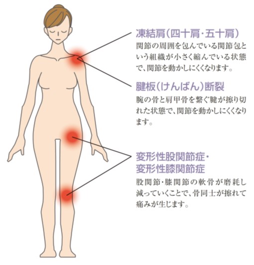 関節痛の基礎知識 病院紹介 一宮西病院 社会医療法人 杏嶺会