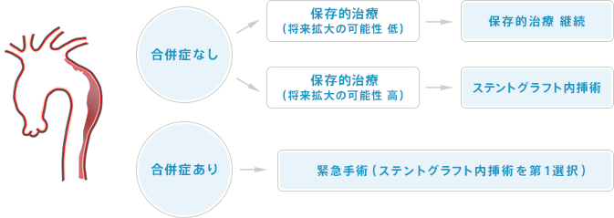 急性B型大動脈解離