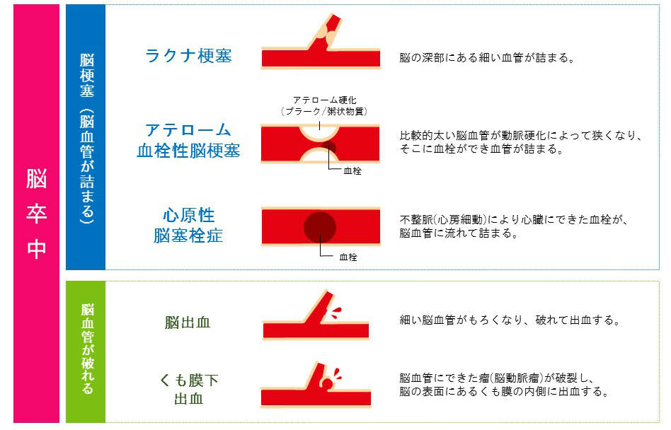 細胞 死ぬ 脳