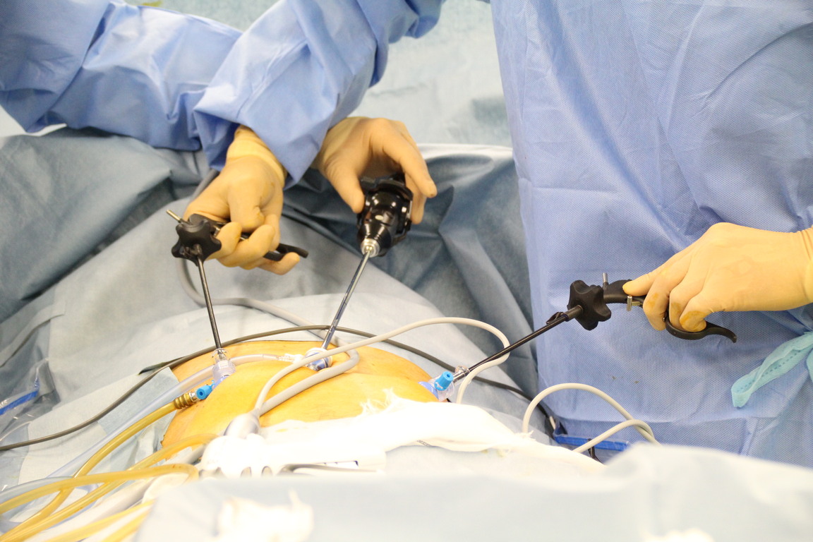 誰がそれを必要とするでしょうか?