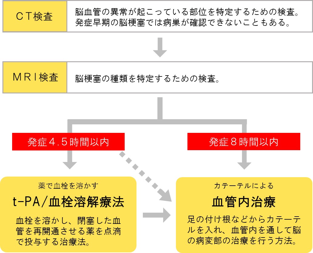 脳 梗塞 治療