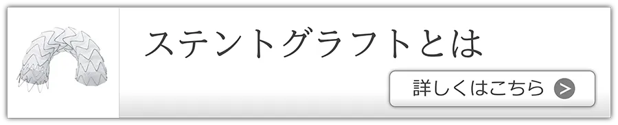 ステントグラフトとは