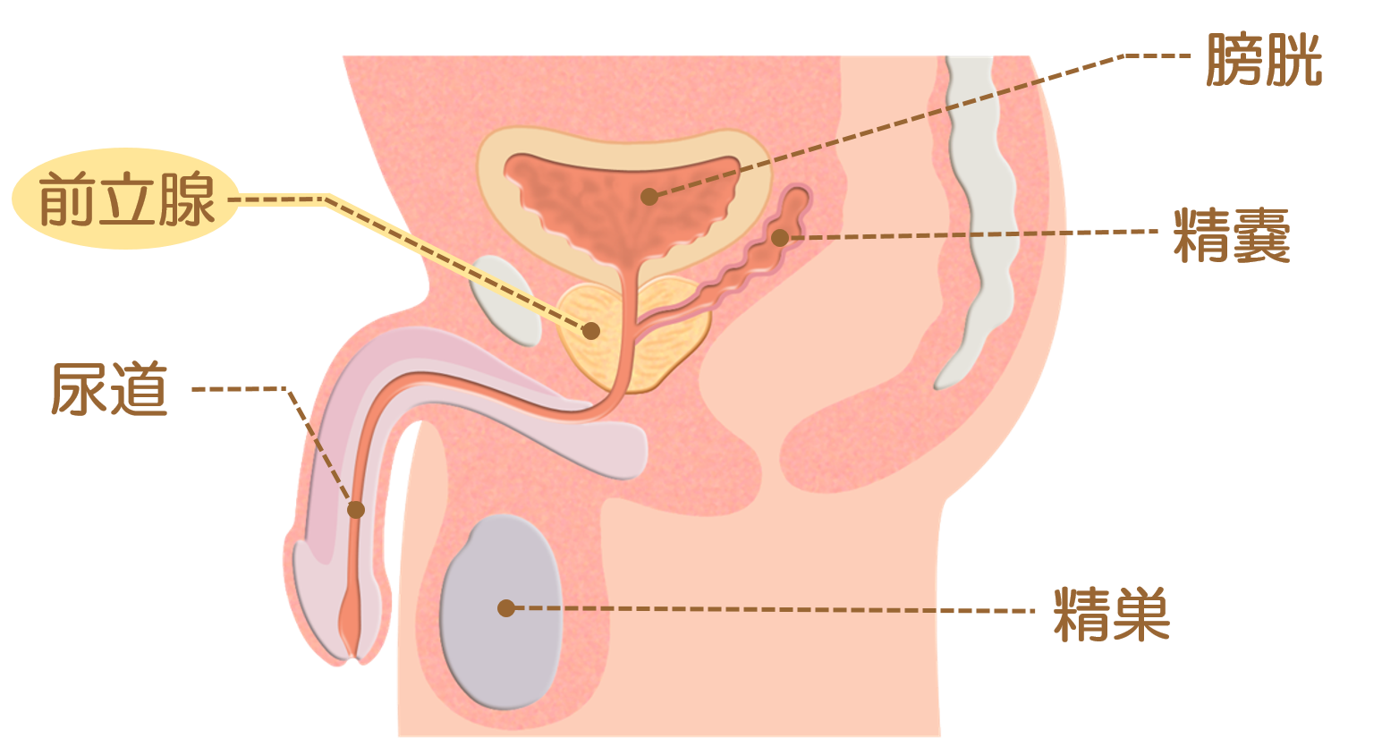 前立腺がん治療の副作用に対する市販薬および処方薬